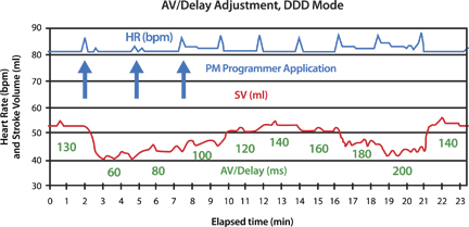 av_delay_adjustment