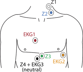 diagram_electrode_placement