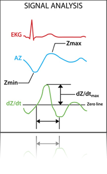 signal_analysis_diag